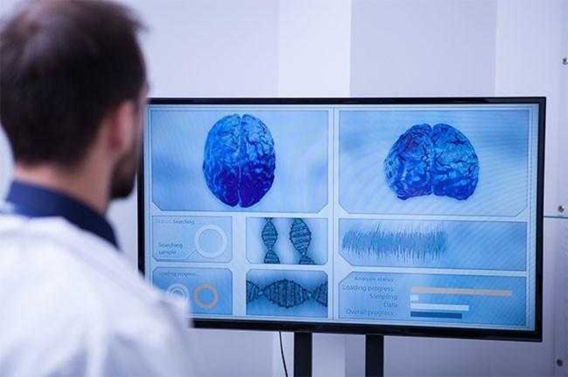 Neurology Software Market: A Comprehensive Overview